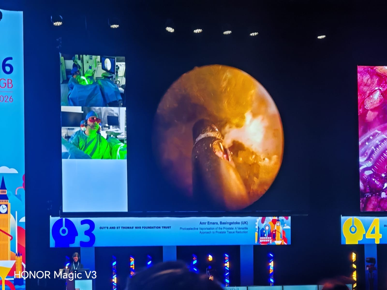 Our Consultant Surgeons Shine at EAU Annual Congress 2026